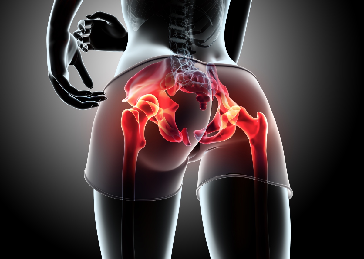 Bolovi u nogama iznad koljena i bolovi u bedrima – uzroci, simptomi i liječenje