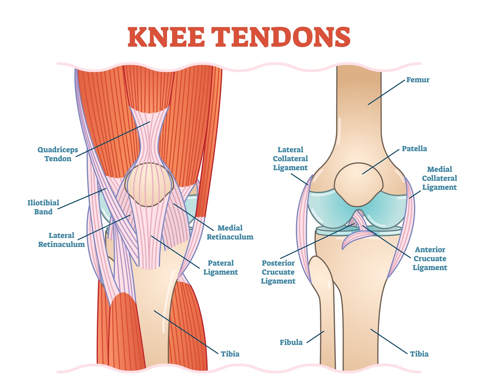 tetiva boli mišića zglobova bol na lijevoj strani koljena